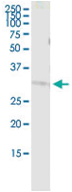 anti-COASY, Human, IP-WB Antibody Pair, Abnova 1 Set:Antibodies, Monoclonal/Polyclonal
