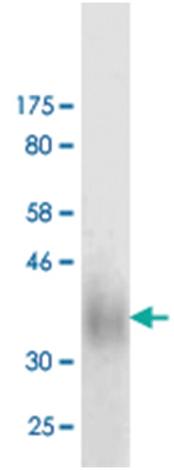 anti-PDCD1LG2, Clone: 7F2, Abnova 100 &mu;g | Buy Online | Abnova | Fisher Scientific