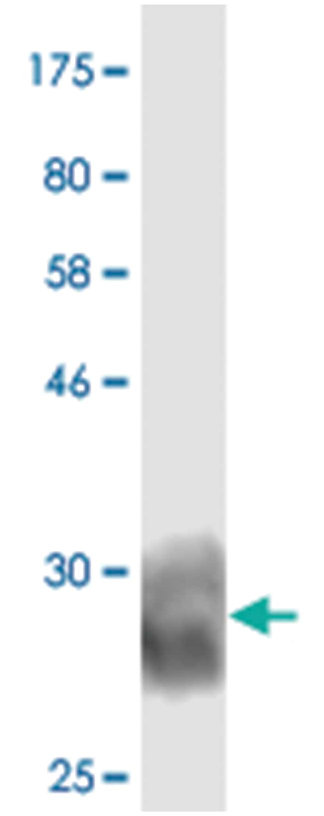anti-CD276, Clone: 6D1, Abnova 100μg, Unlabeled:Antibodies, Monoclonal ...