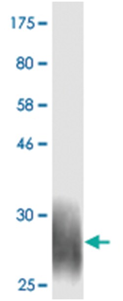 CD276 (M30), Mouse anti- Human, Clone: 3E4, Abnova 100&mu;g, Unlabeled:Antibodies,