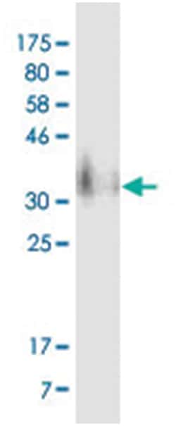 anti-CD276, Clone: 7B9, Abnova 100 &mu;g | Buy Online | Abnova Corporation | Fisher Scientific