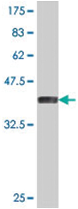 ESX1L, Mouse, Polyclonal Antibody, Abnova 50&mu;L; Unlabeled:Antibodies,