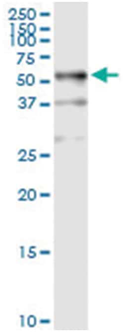 anti-TUBB1, Human, IP-WB Antibody Pair, Abnova&trade;