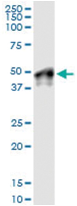Abnova Corporation anti-WNT5B, Human, IP-WB Antibody Pair, Abnova™