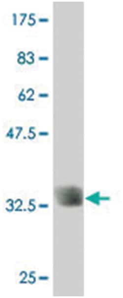 SLC2A10, Mouse, Polyclonal Antibody, Abnova 50&mu;L; Unlabeled:Antibodies,