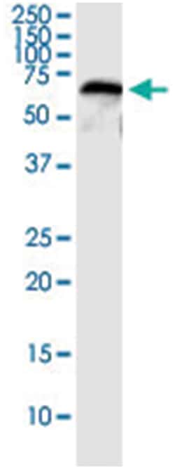 anti-CFHR5, Human, IP-WB Antibody Pair, Abnova 1 Set:Antibodies, Monoclonal/Polyclonal