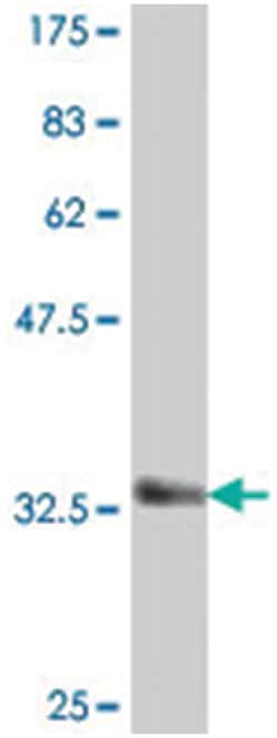 COL21A1, Mouse, Polyclonal Antibody, Abnova 50&mu;L; Unlabeled:Antibodies,