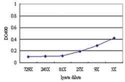 anti-CDADC1 Matched Antibody Pair, Abnova 1 Set | Buy Online | Abnova Corporation | Fisher Scientific