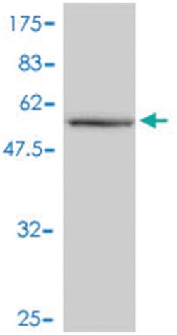 CAB39L, Mouse, Polyclonal Antibody, Abnova 50&mu;L; Unlabeled:Antibodies,