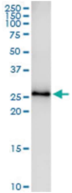 TSSK3, Human, IP-WB Antibody Pair (PW1), Abnova&trade;