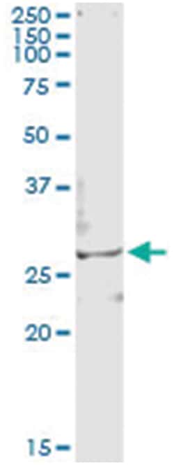 TSSK3, Human, IP-WB Antibody Pair (PW2), Abnova&trade;