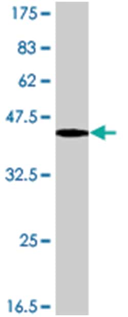 MAP1LC3B (A02), Mouse anti-Human, Polyclonal Antibody, Abnova 50 &mu;L | Buy Online | Abnova Corporation | Fisher Scientific