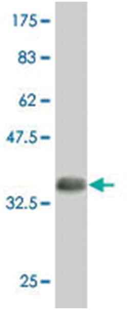 SBF2, Mouse, Polyclonal Antibody, Abnova 50&mu;L; Unlabeled:Antibodies,