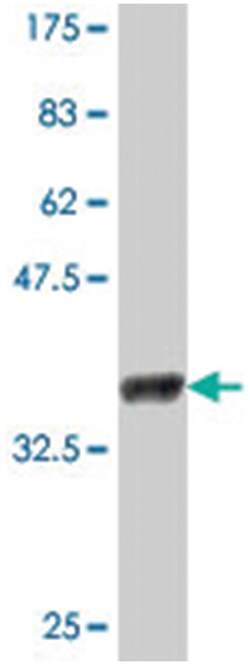 RTP3 (TMEM7), Mouse, Polyclonal Antibody, Abnova 50&mu;L; Unlabeled:Antibodies,