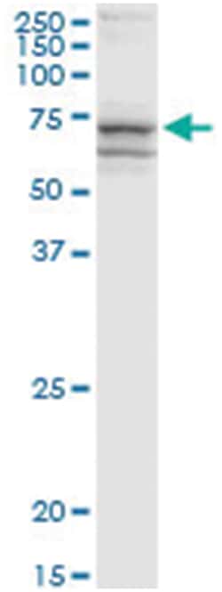 anti-RIOK1, Human, IP-WB Antibody Pair, Abnova&trade;