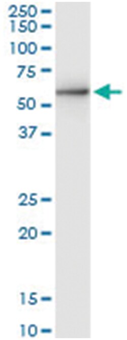 anti-STK40, Human, IP-WB Antibody Pair, Abnova&trade;