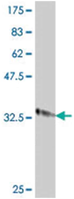 IMMP2L, Mouse, Polyclonal Antibody, Abnova 50&mu;L; Unlabeled:Antibodies,