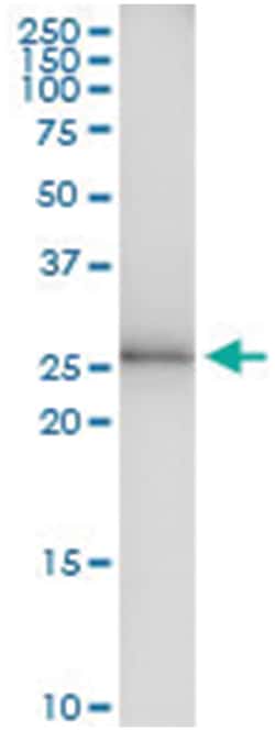 Abnova Corporation anti-TSSK6, Human, IP-WB Antibody Pair, Abnova™