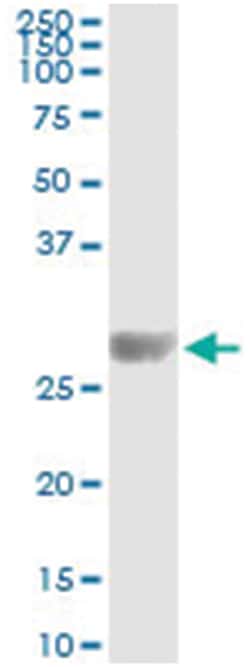 anti-KIRREL2, Human, IP-WB Antibody Pair, Abnova&trade;