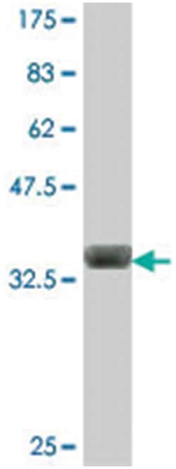 ASCC2, Mouse, Polyclonal Antibody, Abnova 50&mu;L; Unlabeled:Antibodies,