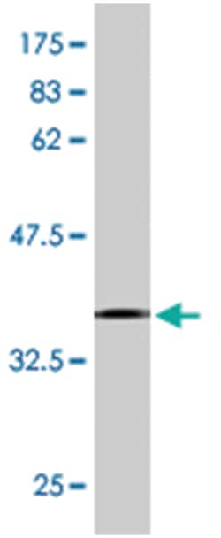 ASCC2, Mouse, Clone: 2F7, Abnova 200&mu;L; Unlabeled:Antibodies, Monoclonal