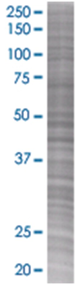 RBED1 293T Cell Overexpression Lysate (Denatured), Abnova 100 &mu;L | Buy Online | Abnova | Fisher Scientific