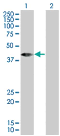 RBED1 293T Cell Overexpression Lysate (Denatured), Abnova 100 &mu;L | Buy Online | Abnova | Fisher Scientific