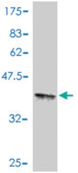 CARD11, Mouse, Polyclonal Antibody, Abnova 50&mu;L; Unlabeled:Antibodies,