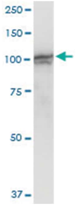 anti-PGBD1, Human, IP-WB Antibody Pair, Abnova™