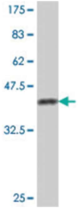 MAP1LC3A, Mouse, Polyclonal Antibody, Abnova 50μL; Unlabeled:Antibodies,