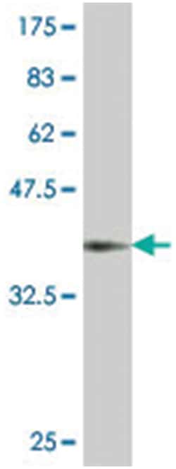 MYPN, Mouse, Polyclonal Antibody, Abnova 50&mu;L; Unlabeled:Antibodies,