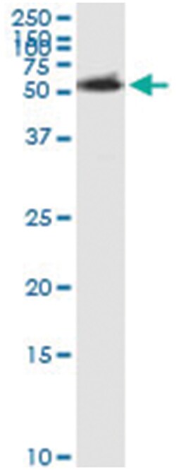 anti-ACCS, Human, IP-WB Antibody Pair, Abnova&trade;