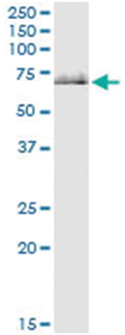 Abnova Corporation anti-GPT2, Human, IP-WB Antibody Pair, Abnova™