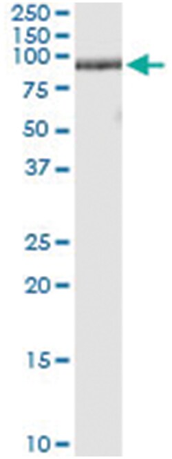 anti-ZNF496, Human, IP-WB Antibody Pair, Abnova&trade;