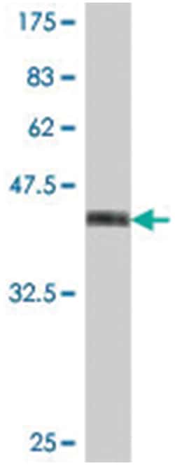 PTPN5, Mouse, Polyclonal Antibody, Abnova 50&mu;L; Unlabeled:Antibodies,