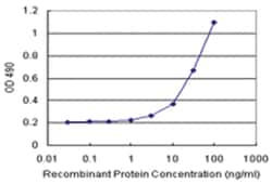 anti-PTPN5 Matched Antibody Pair, Abnova™