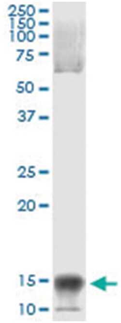 NFATC2IP, Human, IP-WB Antibody Pair (PW2), Abnova&trade;