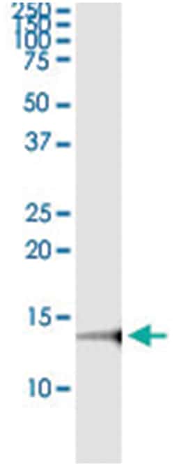 NFATC2IP, Human, IP-WB Antibody Pair (PW3), Abnova™