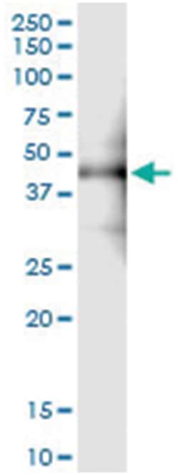ZFYVE19, Human, IP-WB Antibody Pair (PW1), Abnova&trade;