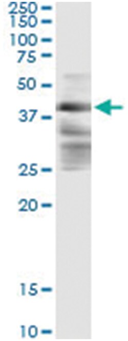 ZFYVE19, Human, IP-WB Antibody Pair (PW2), Abnova™