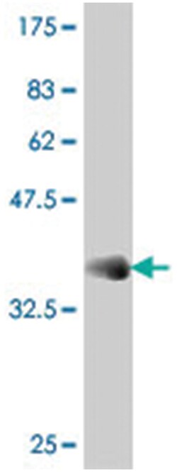 MYLK2, Mouse, Polyclonal Antibody, Abnova 50&mu;L; Unlabeled:Antibodies,