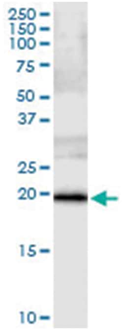 anti-SSH2, Human, IP-WB Antibody Pair, Abnova&trade;