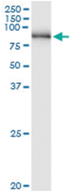 anti-PNPT1, Human, IP-WB Antibody Pair, Abnova™