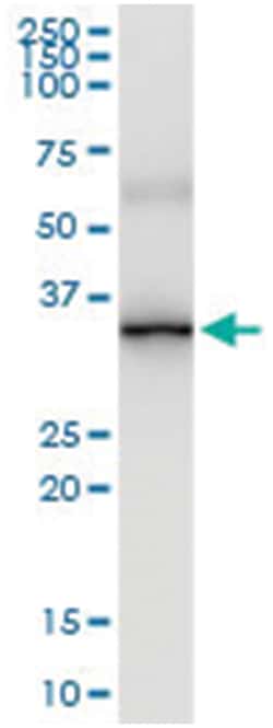 anti-ABCC10, Human, IP-WB Antibody Pair, Abnova™