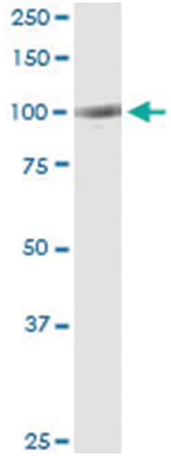 anti-FGD3, Human, IP-WB Antibody Pair, Abnova&trade;