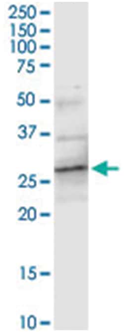 anti-ATP6V1E2, Human, IP-WB Antibody Pair, Abnova&trade;