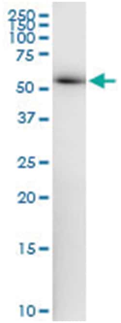 anti-ZNF622, Human, IP-WB Antibody Pair, Abnova&trade;