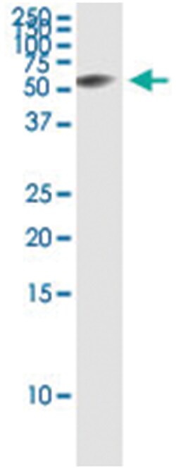 anti-ESAM, Human, IP-WB Antibody Pair, Abnova™