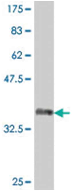 COL23A1, Mouse, Polyclonal Antibody, Abnova 50 &mu;L | Buy Online | Abnova | Fisher Scientific
