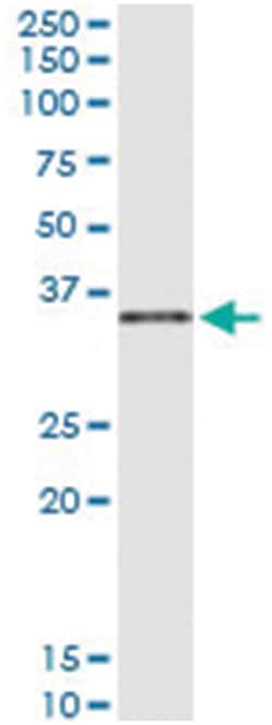 anti-COL23A1, Human, IP-WB Antibody Pair, Abnova 1 Set | Buy Online | Abnova Corporation | Fisher Scientific